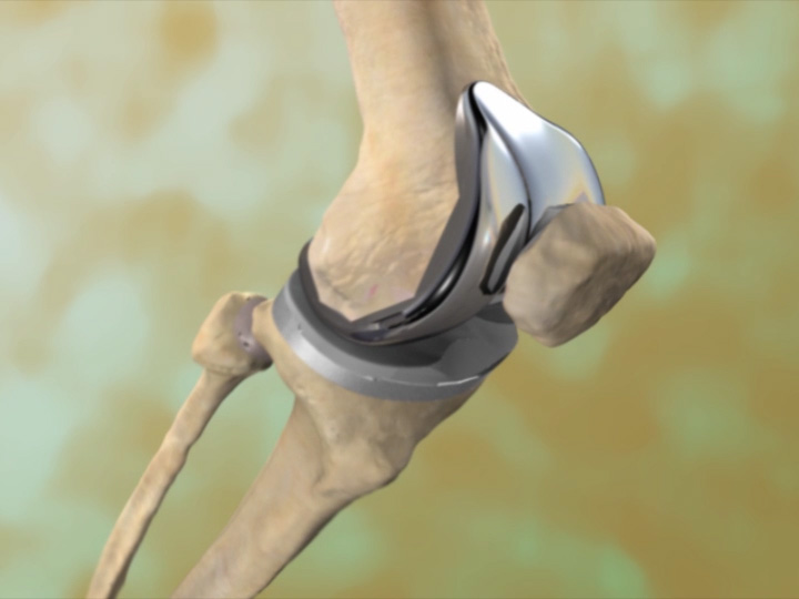 Spine Surgeon in Jaipur Spine Surgeon in Jaipur